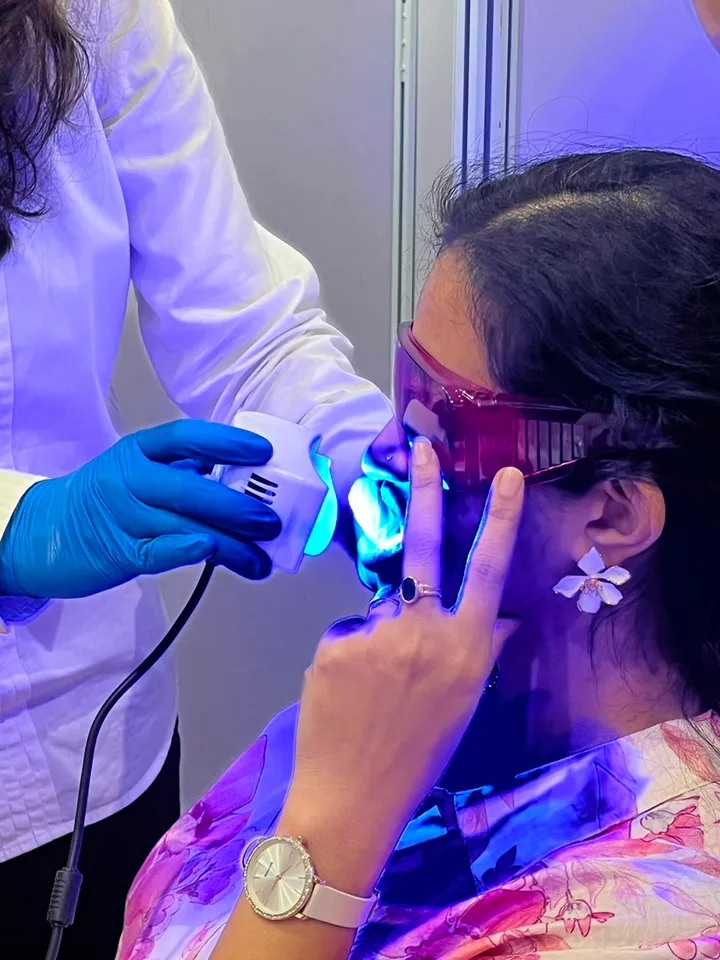 Teeth whitening — before and after